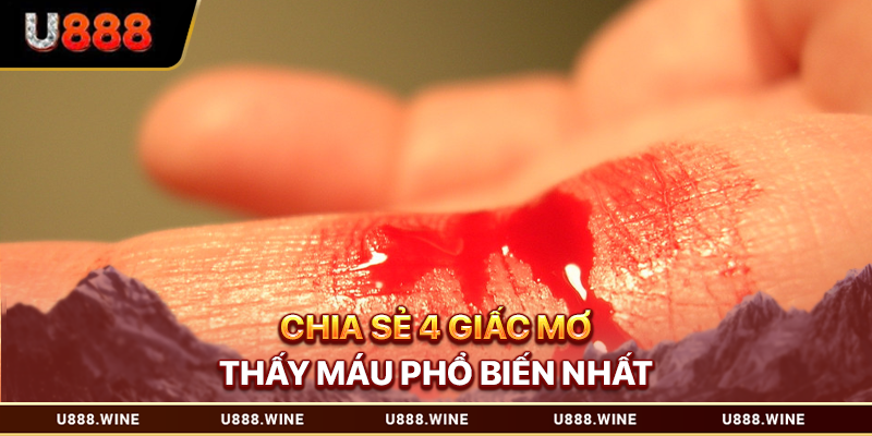 Mơ Thấy Máu - Ý Nghĩa Hình Ảnh Và Cách Chốt Số May Mắn 2026 Chia sẻ 4 giấc mơ thấy máu phổ biến nhất